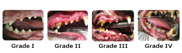4-stages-of-dental-disease
